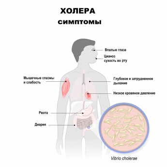 Что такое холера и насколько она опасна для жизни